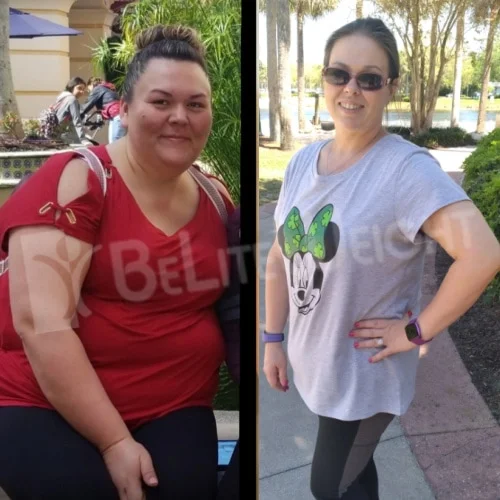 Amy C - 2 Year Update*